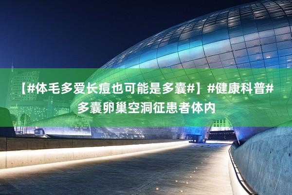【#体毛多爱长痘也可能是多囊#】#健康科普# 多囊卵巢空洞征患者体内