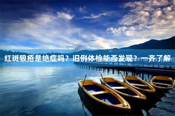 红斑狼疮是绝症吗？旧例体检能否发现？一齐了解